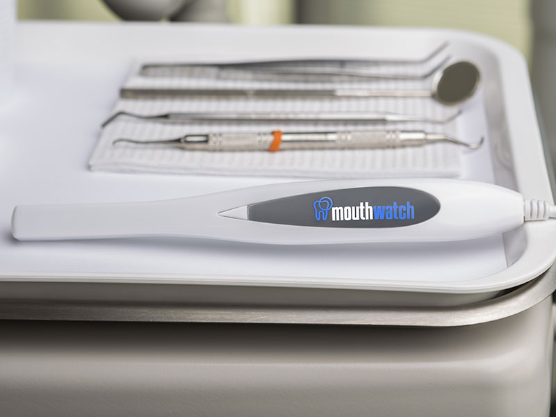 MouthWatch_IntraoralCamera_OnTray1_800x600 mouthwatch intraoral camera on a tray